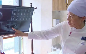 Người phụ nữ 44 tuổi rụng gần hết răng vì thói quen ai cũng dễ bỏ qua