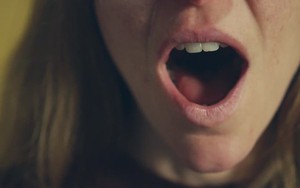 Gãy cổ, liệt nửa người chỉ vì... ngáp