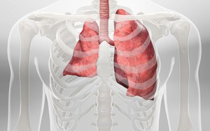 Đang khỏe mạnh bỗng bị xẹp phổi, thanh niên 24 tuổi hối hận vì đã làm 1 điều suốt gần 10 năm