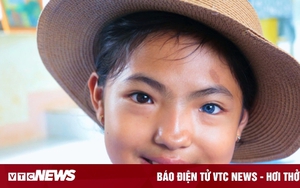 Kỳ lạ bé gái ở Đắk Lắk có hai màu mắt, một bên mắt đen và một bên mắt xanh