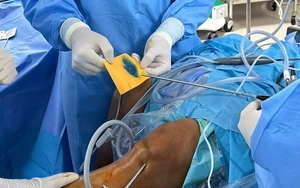 Việt Nam điều trị thành công thoái hóa khớp bằng phương pháp hoàn toàn mới