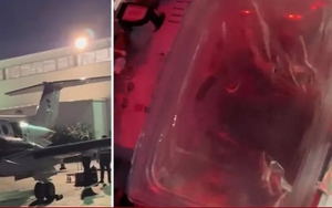 Clip trái tim đang đập trong hộp chờ cấy ghép thu hút 24 triệu lượt thích