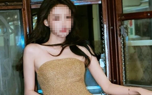 “Mặt sưng phù, phải truyền dịch suốt 2 ngày” vì nhuộm tóc, một nữ diễn viên nổi tiếng thú nhận