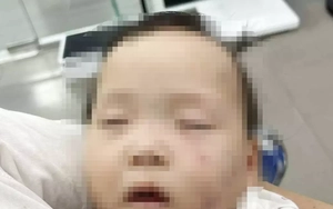 Tạm giữ cô giáo gây thương tích cho trẻ mầm non