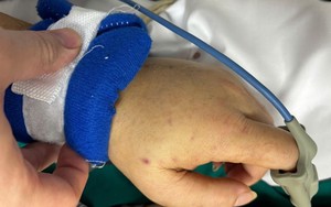 Bệnh viện Bạch Mai phát cảnh báo về 1 căn bệnh nguy hiểm, lây lan nhanh, tỷ lệ tử vong cao