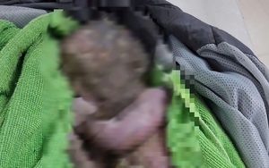 Cứu sống trẻ sơ sinh bị bỏ rơi đã ngừng tim, người đầy bùn đất