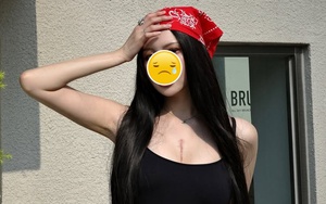 Nữ thần sắc đẹp 29 tuổi qua đời vào sáng nay vì mắc bệnh hiếm gặp