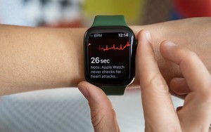 Nghiên cứu: Apple Watch phát hiện sớm nguy cơ đột quỵ tốt hơn cả khám định kỳ