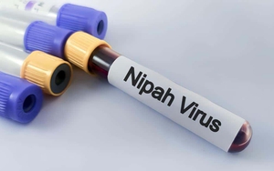 Vi rút Nipah nguy hiểm ra sao?