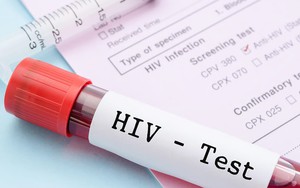 1 thành phố ghi nhận hơn 3.000 ca nhiễm HIV mới trong 9 tháng đầu năm 2025: 81% lây qua con đường này