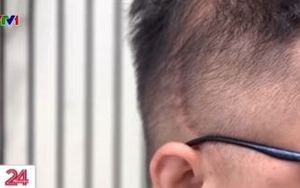 Theo tôi, đây là chi tiết ĐÁNG SỢ nhất trong vụ Trung tâm Hải Hà bạo hành trẻ!