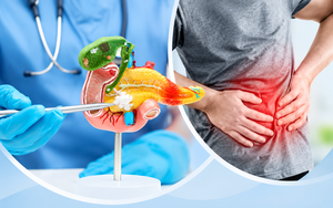 Khám cho nhiều người mắc ung thư tuyến tụy giai đoạn cuối, bác sĩ tiếc nuối: Dấu hiệu xuất hiện sớm nhưng hay bị bỏ qua