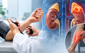 Cần chú ý tới thận nếu có dấu hiệu này