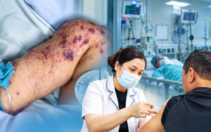 Căn bệnh truyền nhiễm diễn biến tối cấp, đe dọa tính mạng chỉ trong vài giờ: Ghi nhận ổ dịch tại TP.HCM