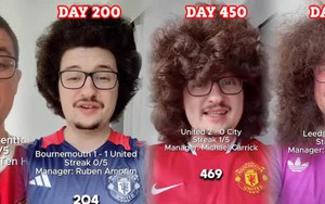 Khổ như fan Manchester United