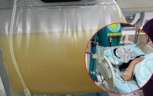 Người phụ nữ 38 tuổi đau bụng dữ dội, máu trắng đục như sữa, bác sĩ cảnh báo nguyên nhân từ thói quen ăn uống quen thuộc