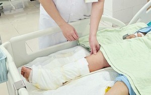 Đau nhói khi xỏ dép đi chợ, người phụ nữ đắp lá ớt rồi nhập viện vì chân hoại tử