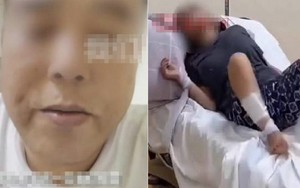 Người đàn ông bị chó cắn 47 ngày rồi qua đời: Bác sĩ nhắc điều phải làm ngay khi có vết thương