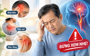 Đau ở 3 vùng này có thể là dấu hiệu sớm của đột quỵ, đừng xem nhẹ!