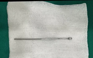 Bé trai 14 tuổi nhập viện vì dị vật dài 12cm trong niệu đạo