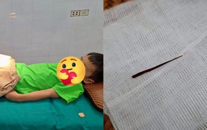 Con trai chịu đau cả buổi chiều không dám báo cô: Bố mẹ đưa đi viện mới lo lắng với chiếc dằm rút ra từ đùi con