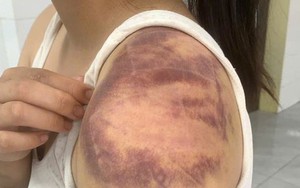 Người đàn ông nhiều lần trói, đánh đập con, vợ đang mang thai trong ngày Tết