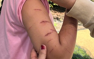 Chủ tịch UBND tỉnh Cà Màu chỉ đạo khẩn vụ nữ sinh lớp 5 bị gây thương tích