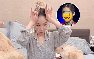 Nữ ca sĩ bị tai nạn đến hủy dung: Vết thương hoại tử 2 tháng, giờ gây sốc với "gương mặt rắn" méo mó