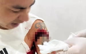 Người đàn ông bị chém trọng thương khi đang ngồi uống cà phê