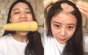 Cuộc sống sang chảnh hiện tại của “cô gái bị hói một mảng đầu vì ăn ngô bằng khoan” 10 năm trước