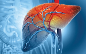 Ung thư gan tại Việt Nam gia tăng báo động: Kiểm soát được 3 thứ này, giảm được 2/3 số ca mắc