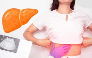 Với gan nhiễm mỡ, ngoài “ngậm miệng và đá chân", còn có 1 việc bắt buộc phải làm mà nhiều người không biết