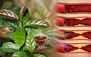 Uống nước xạ đen có giảm mỡ máu?