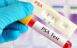 3 ca ung thư tuyến tiền liệt trong 1 ngày, bác sĩ chỉ lý do bệnh dễ bị bỏ sót