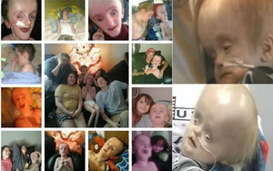 Cậu bé sinh ra không có não sống 12 năm cuộc đời thế nào?