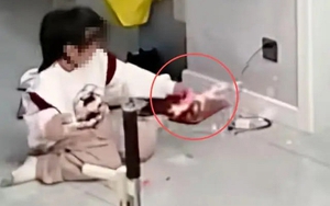 Bé gái bị bỏng khi chơi XẾP HẠT, mẹ xem lại camera vẫn hoảng: “Đây đúng là quả bom vô hình”