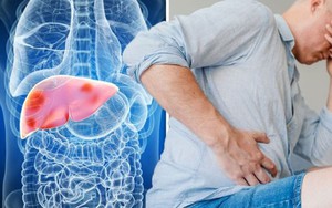 Gan xơ hóa, nhiễm mỡ độ 2 sau 25 năm duy trì 1 thói quen: Bác sĩ nói cần bỏ ngay