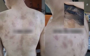 Rúng động Hàn Quốc: Nam nhân viên bị chủ quán hành hạ, ép làm việc 20 giờ/ngày, camera giám sát 24/7