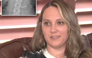 Ăn phải kem có chứa đinh sắt, người phụ nữ được bồi thường 364 tỷ đồng