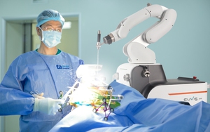 Việt Nam lần đầu có robot AI “tự mổ”: Chính xác đến từng milimet, thế giới mới có 9 nước sở hữu