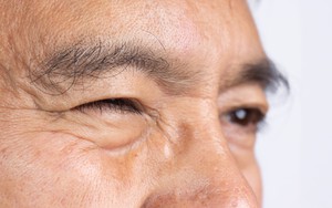Mắt phải giật là điềm xấu, mắt trái giật là điềm may? Bác sĩ nhãn khoa tiết lộ sự thật
