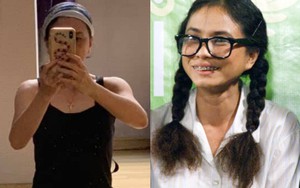 Nữ NSƯT đóng vai Cô Gái Xấu Xí bị 28 vết xẹo trên mặt vì tai nạn, cuộc sống hiện tại ra sao?