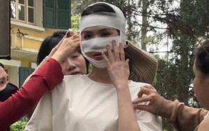 Hình ảnh Ngọc Trinh băng bó kín cả mặt