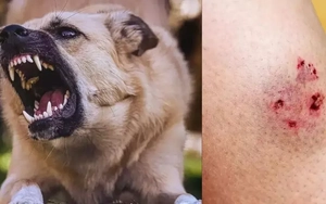 Chó 'điên' cắn 4 người ở Quảng Ngãi dương tính vi rút dại