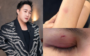 Mới nhất drama hành hung nữ bác sĩ: Trung Quân thông báo ngưng hoạt động rồi xoá post sau 10 phút