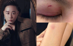 Ca sĩ Trung Quân Idol bị tố hành hung phụ nữ: Luật sư nói gì về trách nhiệm pháp lý?