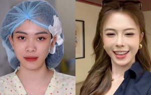 Hà Môi “đắp tiền lên mặt” để sửa những gì? Còn chiếc mũi “đang hếch dần và méo” giờ ra sao?