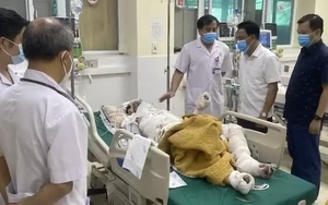 3 người bị bỏng rất nặng khi chữa cháy rừng ở Điện Biên