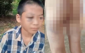 Chi tiết cực đắt trong vụ bé lớp 6 nghi bị mẹ kế và cha bạo hành: Chúng ta cần nhìn lại để dạy con mình!