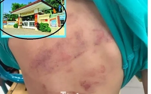Học sinh lớp 1 bị bạn đánh hội đồng, phụ huynh bức xúc vì con phải chuyển lớp